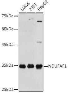 Western blot analysis of extracts of various cell lines, using Anti-NDUFAF1 Antibody [ARC2091] (A306937) at 1:1000 dilution