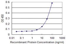 Anti-IRF5 Mouse Monoclonal Antibody [clone: 2G9]