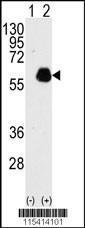 Anti-PXN Rabbit Polyclonal Antibody (HRP (Horseradish Peroxidase))