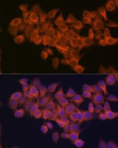 Immunofluorescence analysis of HeLa cells using Anti-NDUFAF1 Antibody [ARC2091] (A306937) at a dilution of 1:100 (40x lens). DAPI was used to stain the cell nuclei (blue)