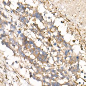 Anti-IL-15 Rabbit Monoclonal Antibody [clone: ARC53689]