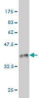 Anti-CDKL1 Mouse Monoclonal Antibody [clone: 3G8]