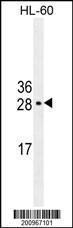 Anti-UBTD1 Mouse Monoclonal Antibody [clone: 189CT14.5.4]