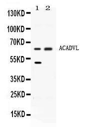 Anti-ACADVL Rabbit Polyclonal Antibody