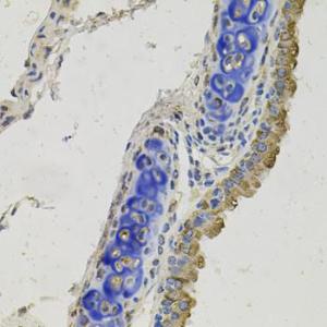 Immunohistochemistry analysis of paraffin-embedded mouse lung using Anti-GAS 6 Antibody (A12278) at a dilution of 1:100 (40X lens). Perform microwave antigen retrieval with 10 mM PBS buffer pH 7.2 before commencing with IHC staining protocol