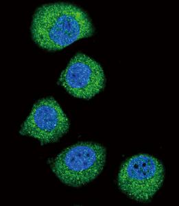 Anti-FGFR2 Rabbit Polyclonal Antibody (HRP (Horseradish Peroxidase))