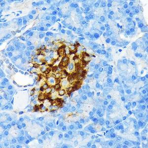 Immunohistochemistry analysis of paraffin-embedded rat pancreatic islet using Anti-Insulin Antibody [ARC0209] (A306938) at a dilution of 1:100 (40X lens). Perform microwave antigen retrieval with 10 mM PBS buffer pH 7.2 before commencing with IHC staining protocol