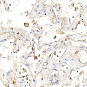 Anti-IL-15 Rabbit Monoclonal Antibody [clone: ARC53689]