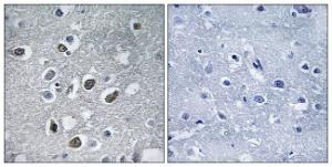 Immunohistochemical analysis of paraffin-embedded human brain tissue using Anti-MARCH4 Antibody. The right hand panel represents a negative control, where the antibody was pre-incubated with the immunising peptide.