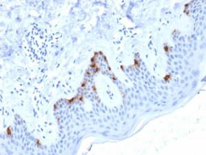 Immunohistochemical analysis of formalin-fixed, paraffin-embedded human skin using Anti-Melanoma gp100 Antibody [PMEL/2038]