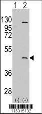 Anti-PRMT8 Rabbit Polyclonal Antibody (HRP (Horseradish Peroxidase))