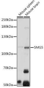 Western blot analysis of extracts of various cell lines, using Anti-SMG5 Antibody (A305640) at 1:1,000 dilution The secondary antibody was Goat Anti-Rabbit IgG H&L Antibody (HRP) at 1:10,000 dilution Lysates/proteins were present at 25 µg per lane