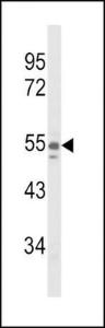 Anti-NAMPT Rabbit Polyclonal Antibody (AP (Alkaline Phosphatase))