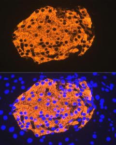 Immunofluorescence analysis of mouse pancreas using Anti-Insulin Antibody [ARC0209] (A306938) at a dilution of 1:100 (40X lens). DAPI was used to stain the cell nuclei (blue)