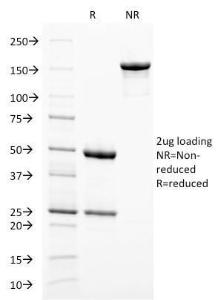 SDS-PAGE analysis of Anti-Melanoma gp100 Antibody [PMEL/2038] under non-reduced and reduced conditions; showing intact IgG and intact heavy and light chains, respectively SDS-PAGE analysis confirms the integrity and purity of the antibody