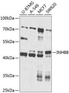 Western blot analysis of extracts of various cell lines, using Anti-Inhibin beta B Antibody (A12280) at 1:1,000 dilution. The secondary antibody was Goat Anti-Rabbit IgG H&L Antibody (HRP) at 1:10,000 dilution.