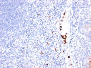 Immunohistochemical analysis of formalin-fixed, paraffin-embedded human tonsil using Anti-MYADM Antibody [MYADM/971]