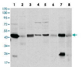 Anti-ASS1 Mouse Monoclonal Antibody [clone: 2C10]