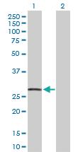 Anti-CDKN1A Rabbit Polyclonal Antibody