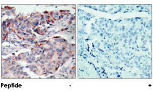 Anti-JAK2 Rabbit Polyclonal Antibody