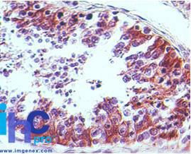 Anti-PTGDR2 Mouse Monoclonal Antibody [clone: 54N3F8]