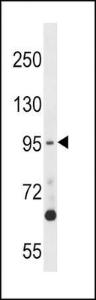 Anti-TTK Rabbit Polyclonal Antibody (Biotin)