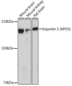 Western blot analysis of extracts of various cell lines, using Anti-Exportin-5 Antibody [ARC0838] (A306939) at 1:1,000 dilution