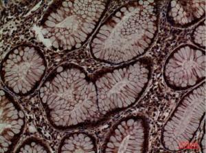 Immunohistochemical analysis of paraffin-embedded human colon using Anti-PDIA3 Antibody