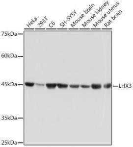 Anti-LHX3/LIM antibody