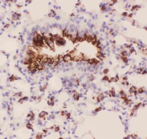 Anti-MUC1 Polyclonal Antibody