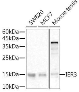 Western blot analysis of extracts of various cell lines, using Anti-IEX1/IER3 Antibody (A12282) at 1:500 dilution