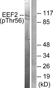 Western blot analysis of lysates from NIH/3T3 cells treated with Serum 10% 30' using Anti-eEF2 (phospho Thr56) Antibody. The right hand lane represents a negative control, where the antibody is blocked by the immunising peptide