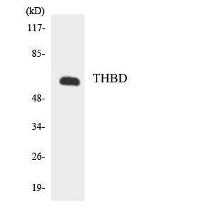 Western blot analysis of the lysates from HeLa cells using Anti-THBD Antibody