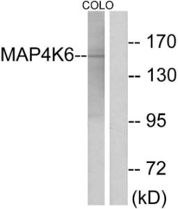 Western blot analysis of lysates from COLO cells using Anti-MAP4K6 Antibody The right hand lane represents a negative control, where the antibody is blocked by the immunising peptide