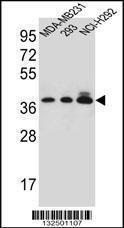 Anti-TAS2R1 Rabbit Polyclonal Antibody