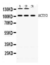 Anti-ACTN3 Rabbit Polyclonal Antibody