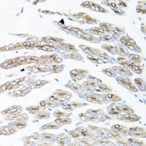 Immunohistochemistry analysis of paraffin-embedded mouse stomach using Anti-IEX1/IER3 Antibody (A12282) at a dilution of 1:100 (40X lens). Perform microwave antigen retrieval with 10 mM PBS buffer pH 7.2 before commencing with IHC staining protocol