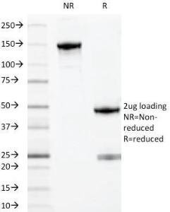 SDS-PAGE analysis of Anti-MYADM Antibody [MYADM/971] under non-reduced and reduced conditions; showing intact IgG and intact heavy and light chains, respectively. SDS-PAGE analysis confirms the integrity and purity of the antibody