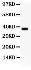 Anti-SLC9A1/Nhe1 Polyclonal Antibody