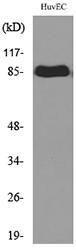 Western blot analysis of lysate from HUVEC cells using Anti-TFRC Antibody