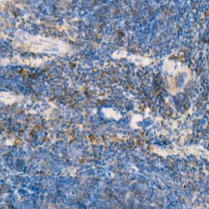 Anti-IL-15 Rabbit Monoclonal Antibody [clone: ARC53689]