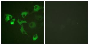 Immunofluorescence analysis of HUVEC cells using Anti-eEF2 (phospho Thr56) Antibody. The right hand panel represents a negative control, where the antibody was pre-incubated with the immunising peptide