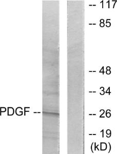 Western blot analysis of lysates from NIH/3T3 cells using Anti-PDGFB Antibody. The right hand lane represents a negative control, where the antibody is blocked by the immunising peptide