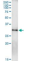 Anti-RAB23 Polyclonal Antibody Pair