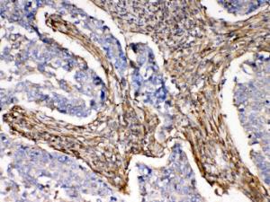 Anti-ACTN3 Rabbit Polyclonal Antibody