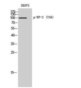 Western blot analysis of SKOV3 cells using Anti-eEF2 (phospho Thr56) Antibody