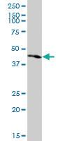 Anti-PKNOX1 Mouse Monoclonal Antibody [clone: 1F12]