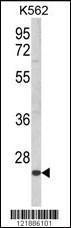 Anti-KLRC2 Rabbit Polyclonal Antibody (AP (Alkaline Phosphatase))