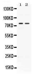 Anti-ACVR2A Rabbit Polyclonal Antibody