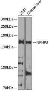 Anti-NPHP3 antibody